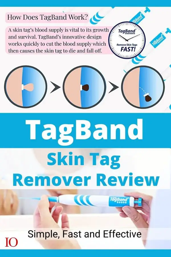 TagBand-Skin Tag Removal Review